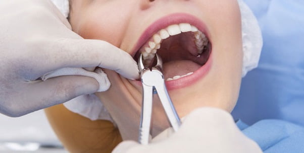 Побочные эффекты после удаления зуба